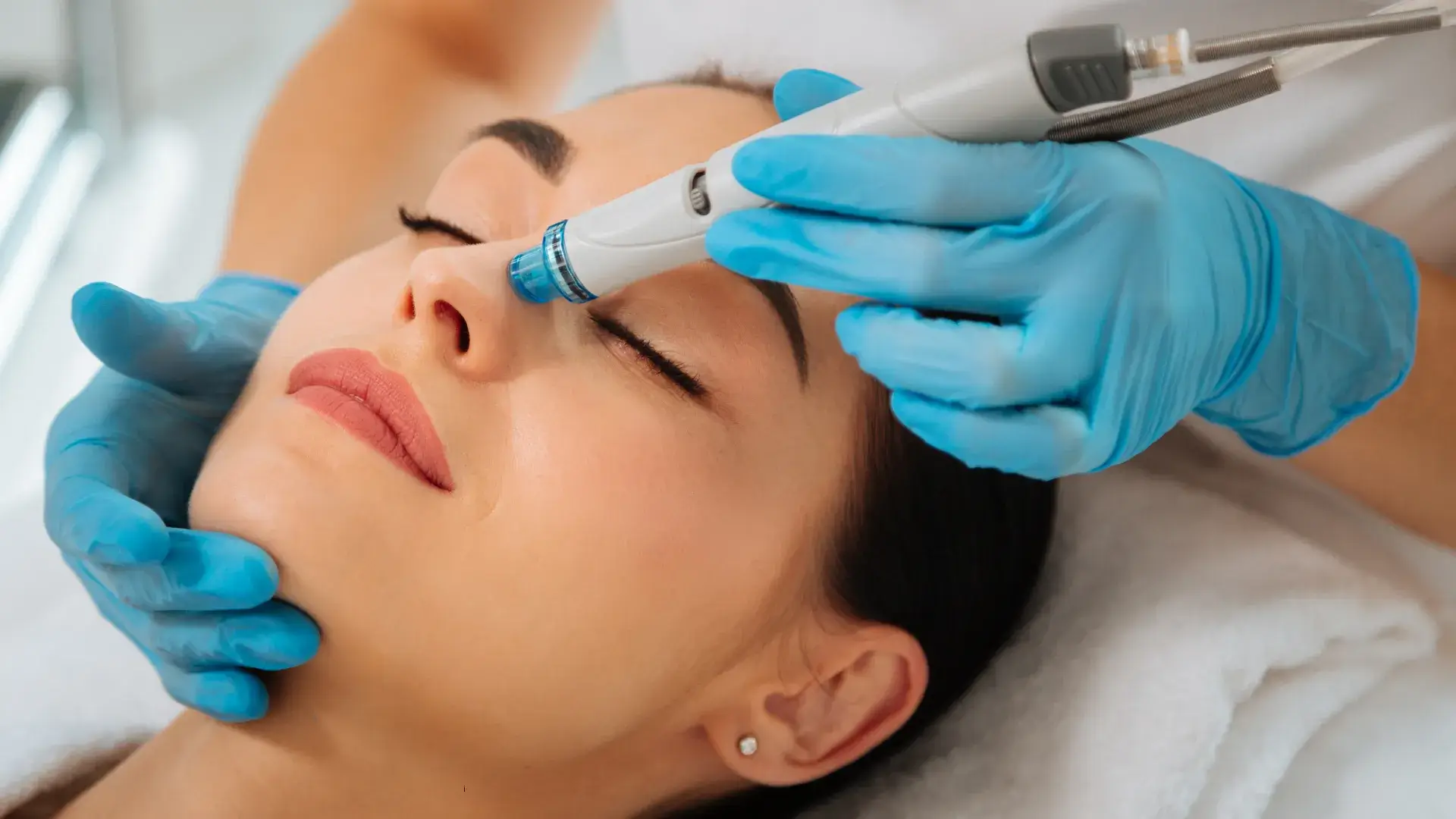Hydrafacial limpieza y nutrición facial avanzada en Albacete