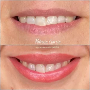 Perfilado de labios con micropigmentación profesional en Albacete