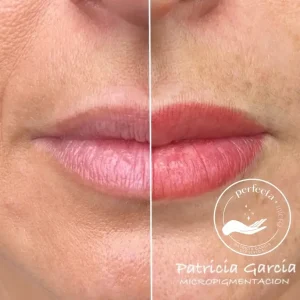 Antes y después de micropigmentación de labios en Albacete